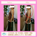 【症例紹介】肩・股関節・膝痛でお困りの60代女性｜新潟市中央区の整体院で姿勢改善ならABCカイロプラクティック整体院